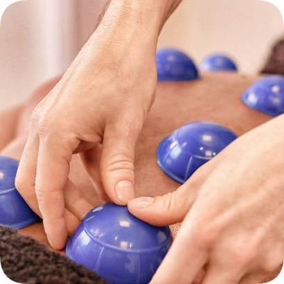 Cupping