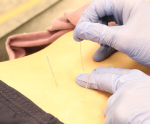 physical-therapy-clinic-dry-needle-cutting-edge-physical-therapy-salt-lake-city-ut